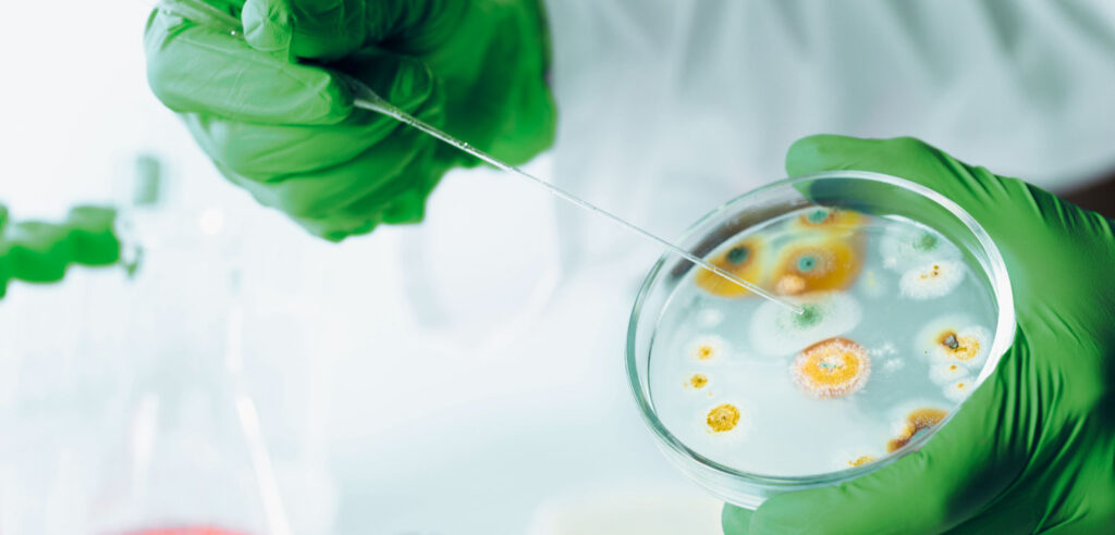 Microorganismos Eficientes: Descubre el Secreto de su Poder, qué contienen y cómo funcionan. 5 analisis de superficies 244428584